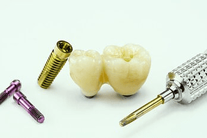 single dental implant chatswood